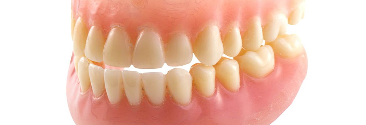 full mouth restauration denture costa rica