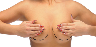 Breast Reduction - Costa Rica